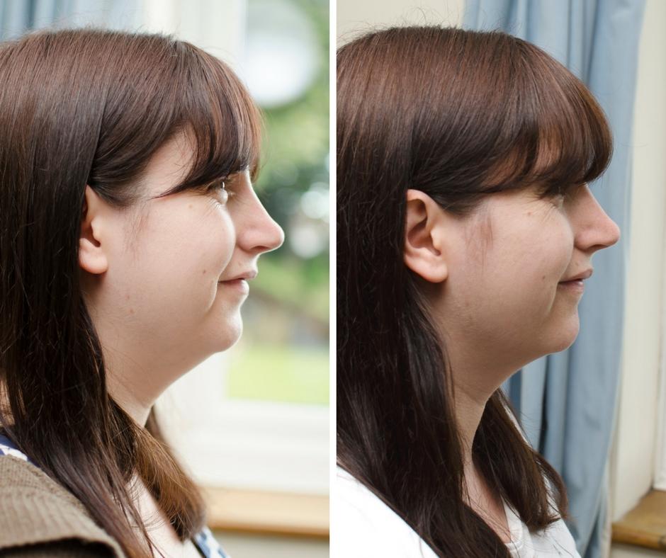 sensse-facial-contour-massager-results