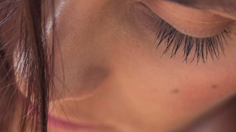 Say goodbye to skin issues using laser treatment
